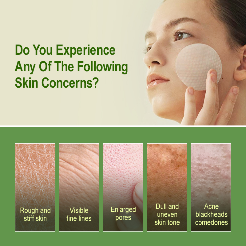 サリチル酸角質除去パッドオイルコントロールにきび除去保湿フェ - Salicylic Acid Blackhead Remover のレビューと価格