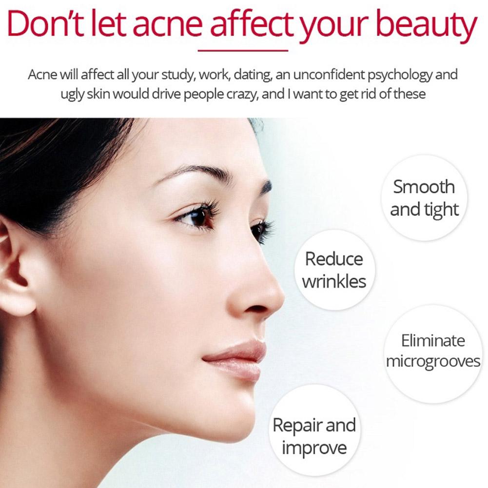 しわ除去クリーム,フェイシャルホワイトニング製品,肌の美しさ - Retinol Anti Wrinkle Cream のレビューと価格