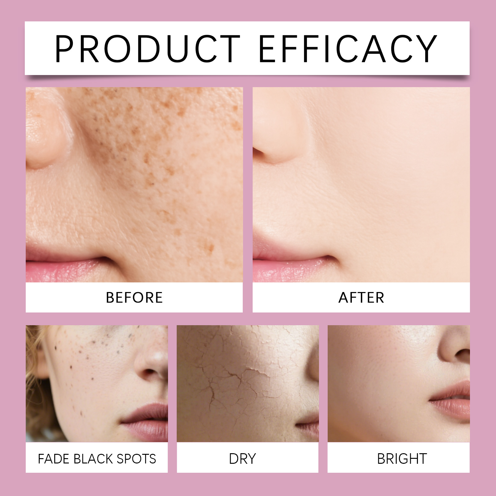 韓国製カルシウムコラーゲンスキンケアセット。ナイアシンアミド - Hyaluronic Acid Facial Serum のレビューと価格