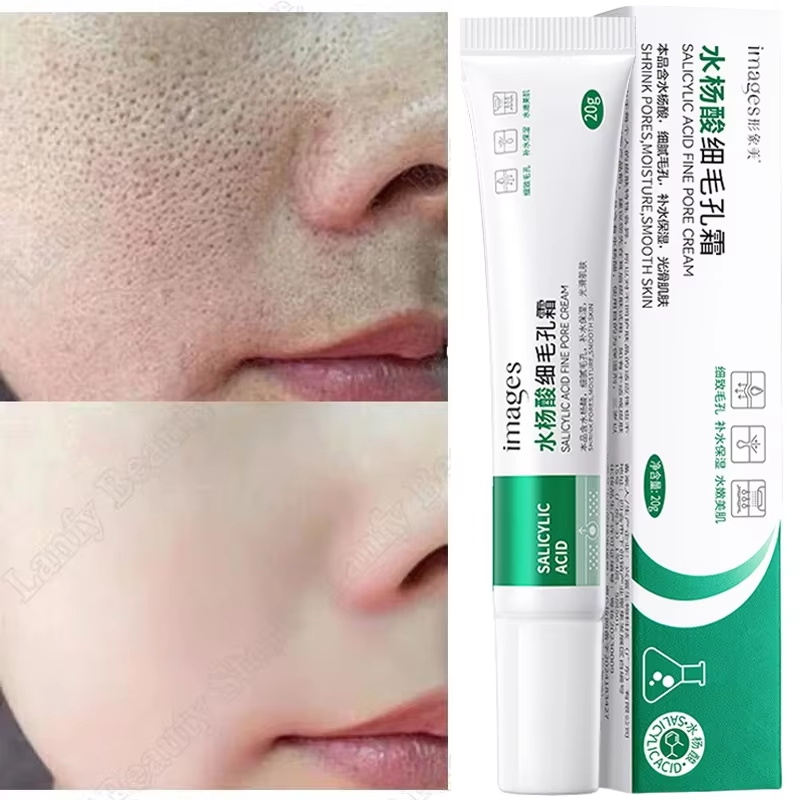 サリチル酸毛穴クリアクリーム毛穴縮小黒ずみ除去ニキビ除去美白 - Salicylic Acid Blackhead Remover のレビューと価格